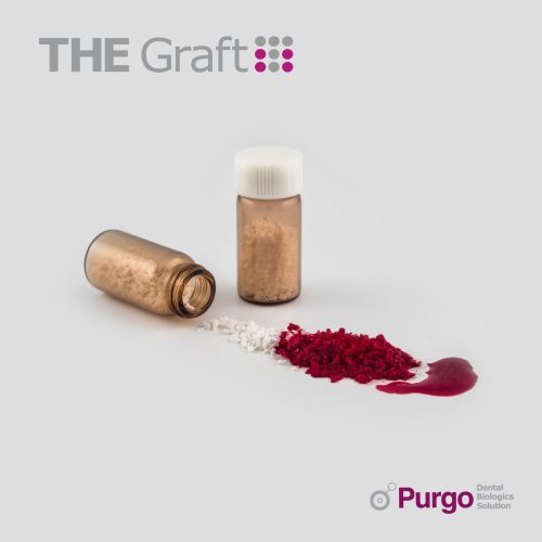 PURGOTHE GRAFT HYDRO Scaled 1 1.jpg PURGOTHE GRAFT HYDRO Scaled 1 1.jpg