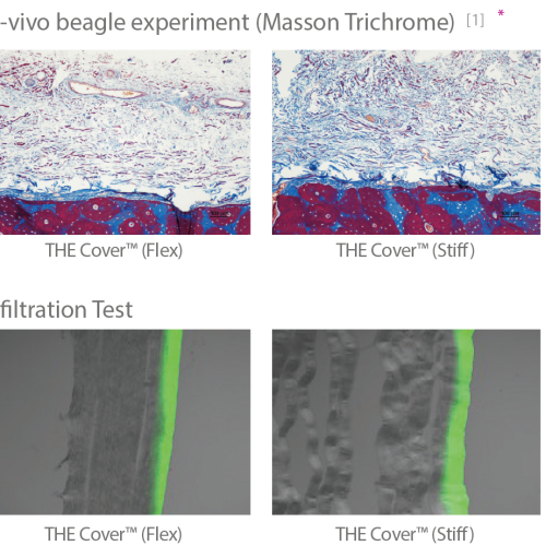 The Cover Purgo 3.png The Cover Purgo 3.png