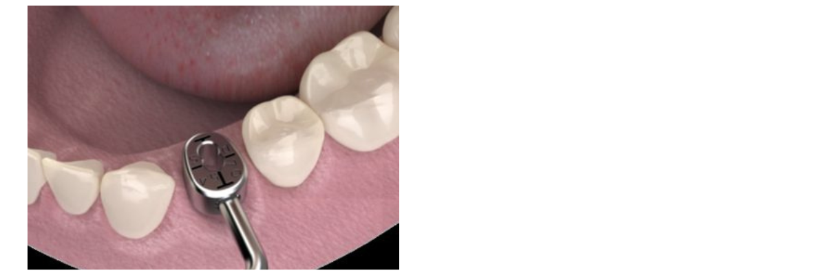 Cervico Premium Kit 1