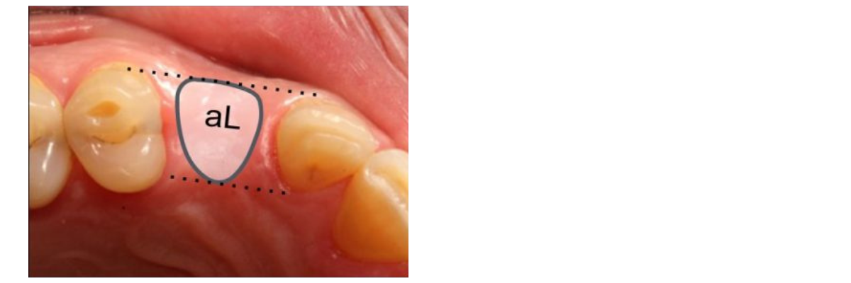 Cervico Premium Kit 2 2