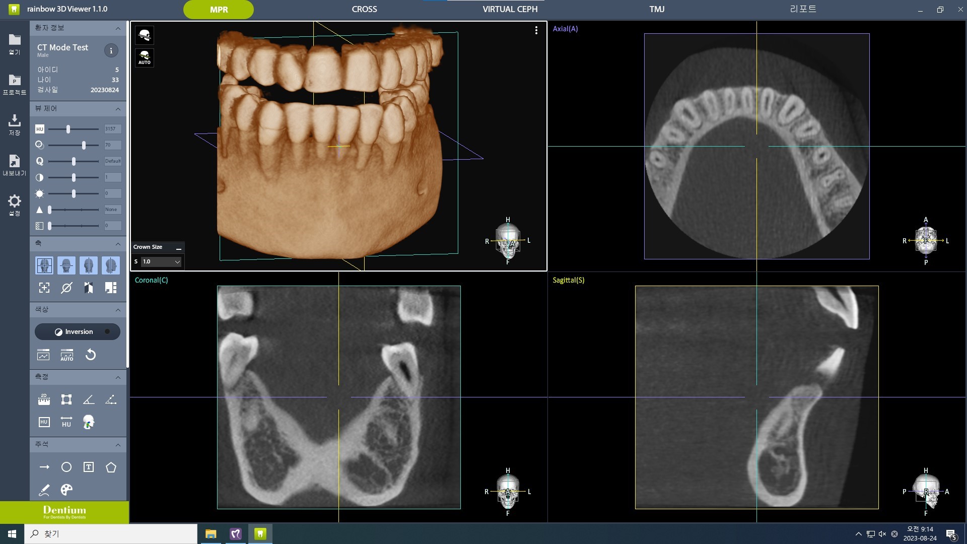 Dentium Rainbow™ CT 1