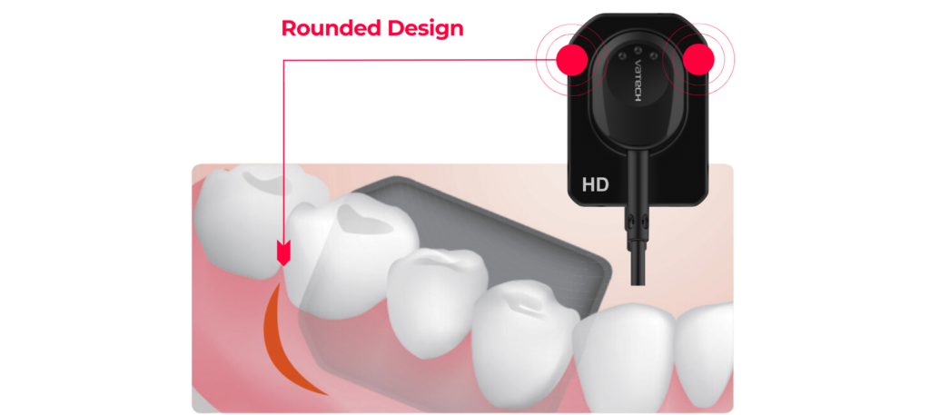 EzSensor HD Image 3 1 1024×576