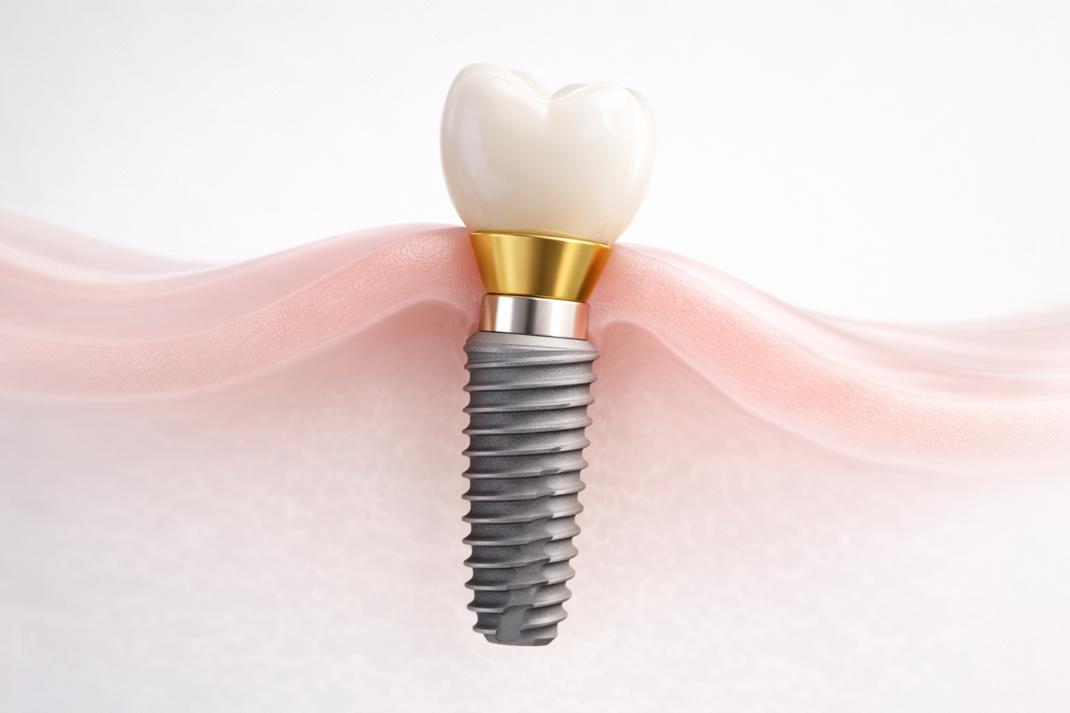 51d267a9 Ea7c 49aa A062 45634d6bb3bf