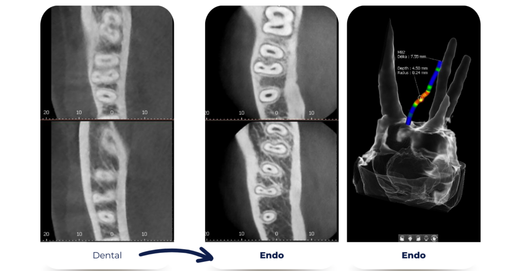 Echipament radiologie dentară Vatech Green X™ 16