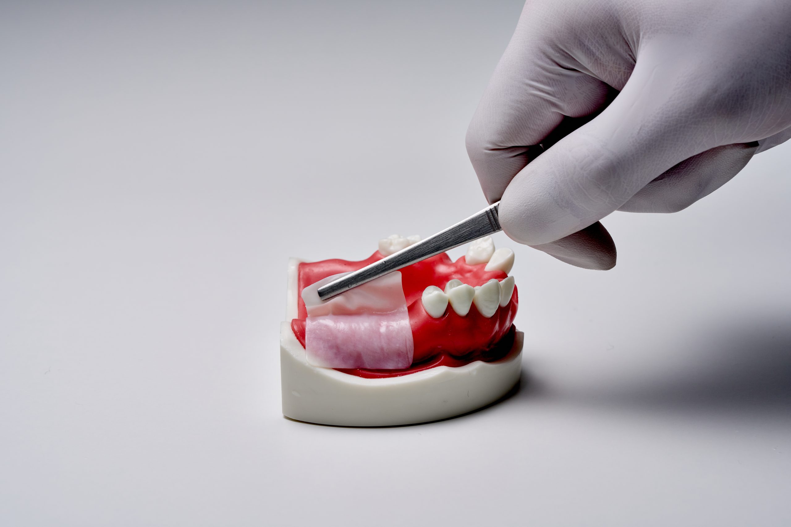 Membrană colagen din peritoneu porcin