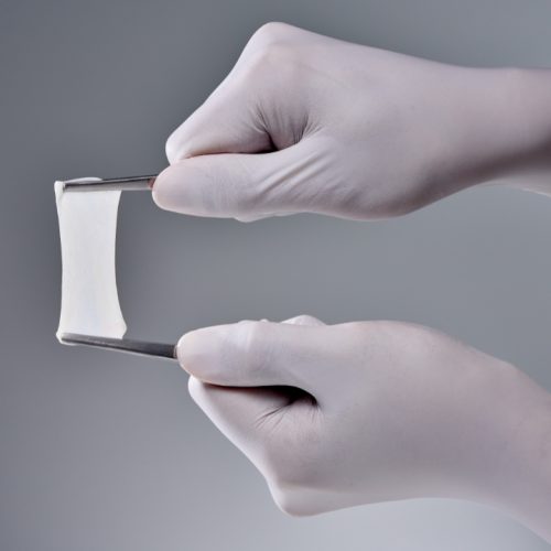 Membrană Colagen Din Peritoneu Porcin Resorbabilă The Cover™ XTEND 2 Membrană Colagen Din Peritoneu Porcin Resorbabilă The Cover™ XTEND 2