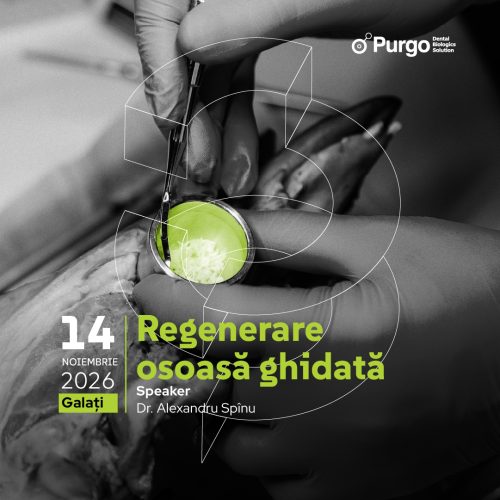 Regenerare Osoasă Ghidată