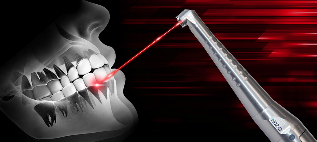 Laserul în stomatologie: Tehnologii și aplicabilitate