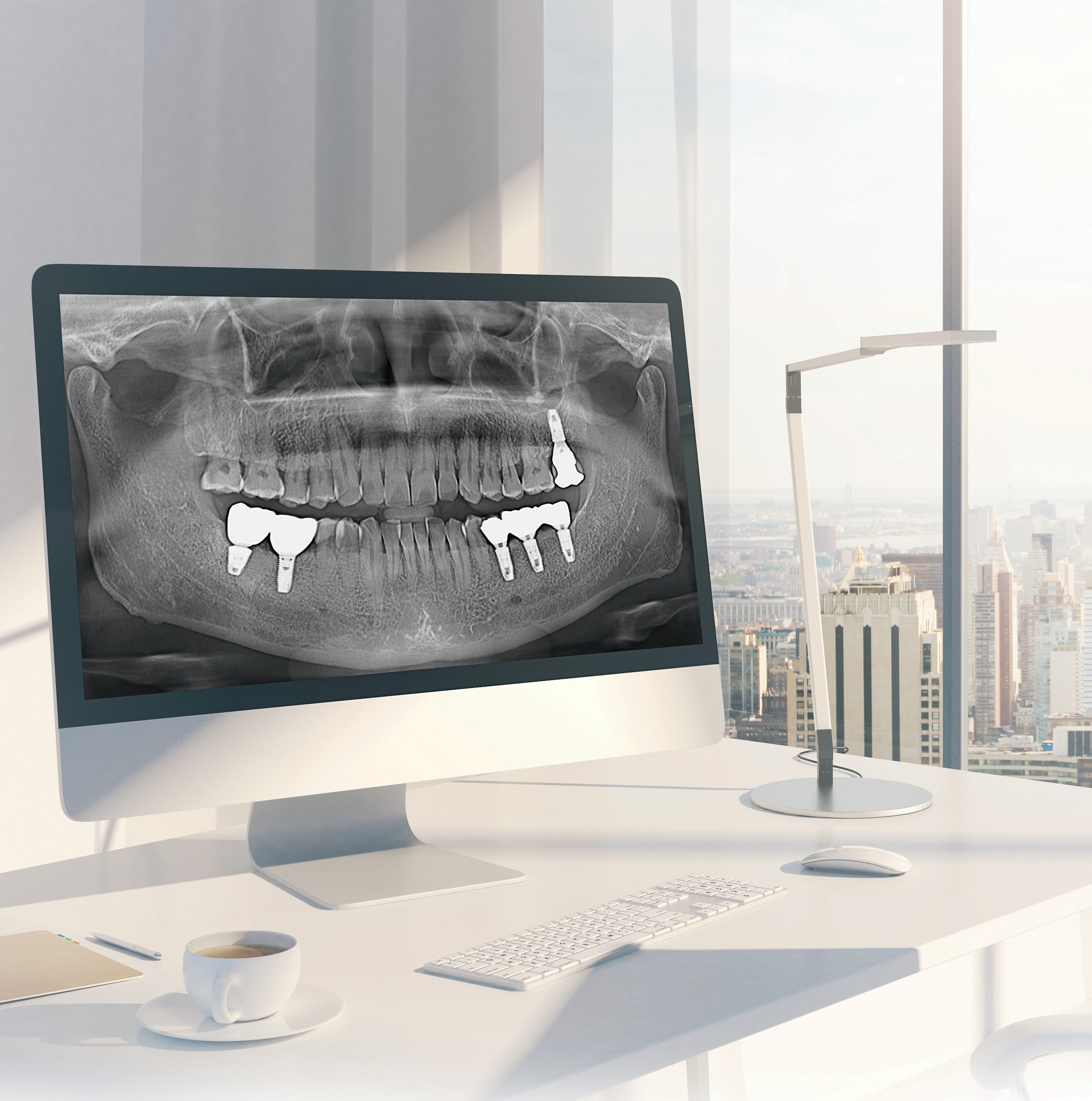 Dentium Rainbow™ CT: Soluția avansată pentru radiologie dentară