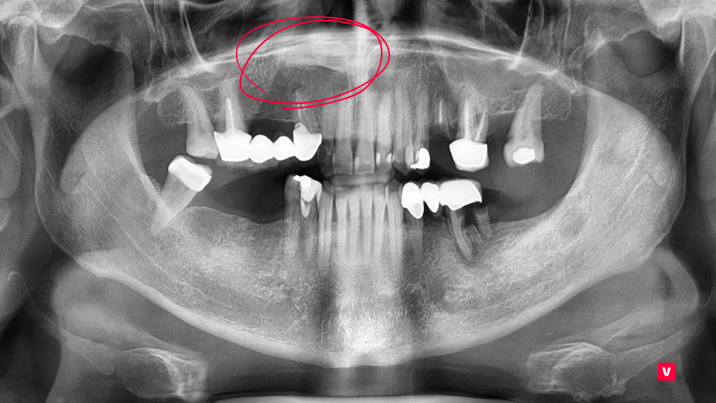 CBCT