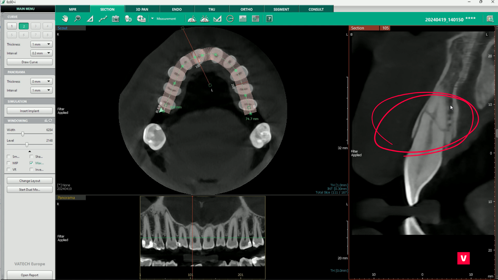 imagistica cbct