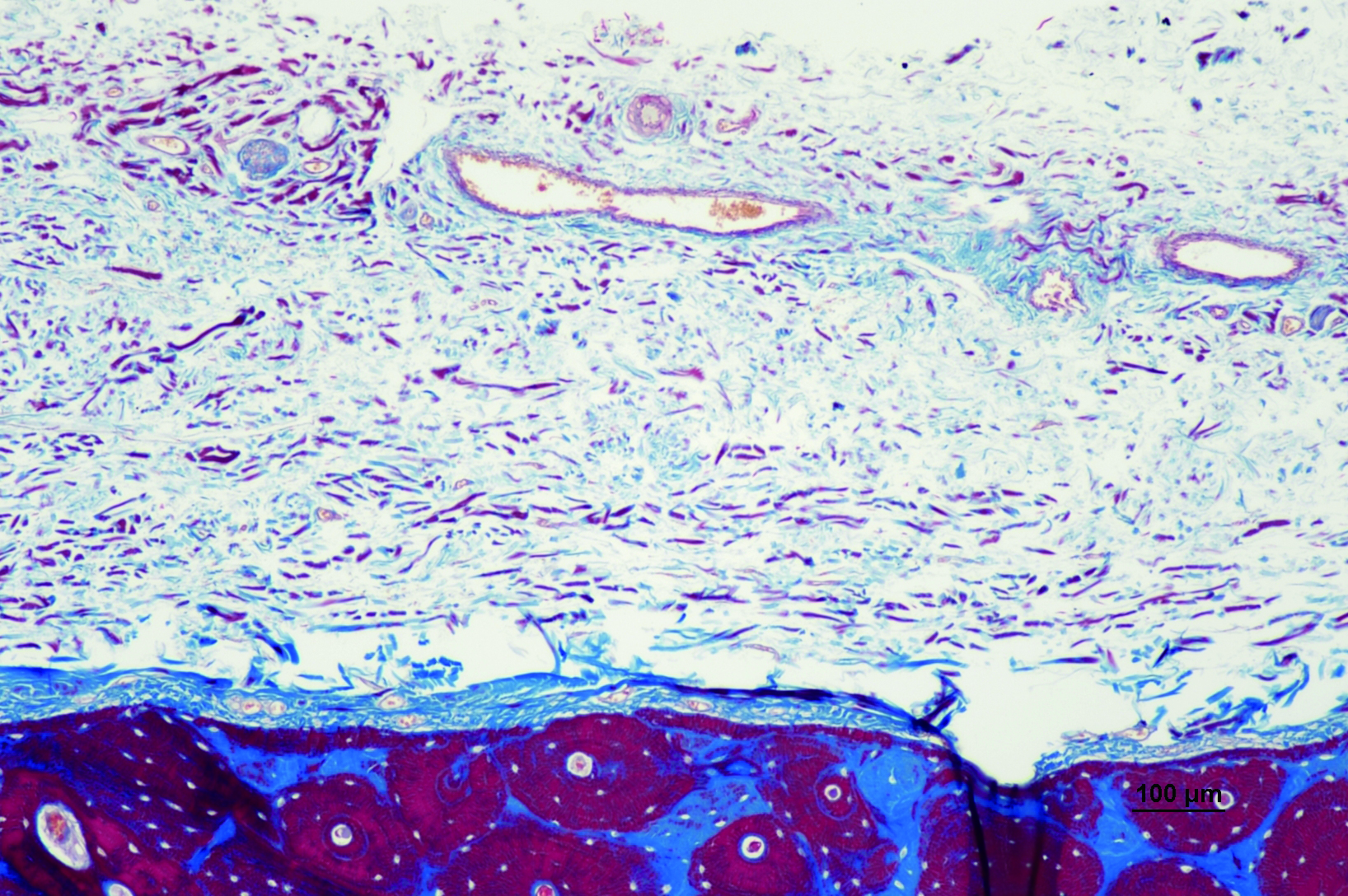 Membrana-de-colagen-the-cover-flex