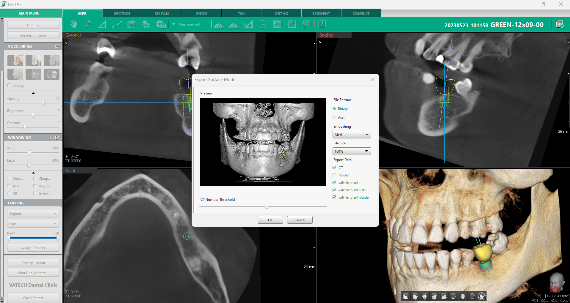 implantologia-moderna-3D