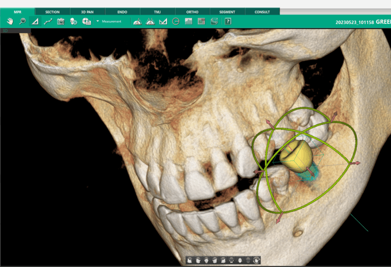 implantologia-moderna-3D