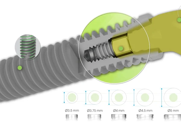 SP1 Implant single platform Southern Implants