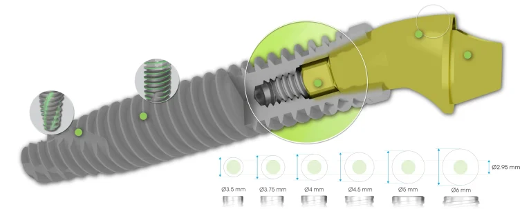 SP1 Implant single platform Southern Implants