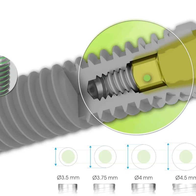 SP1 Implant single platform Southern Implants