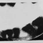 First Radiograph Feature