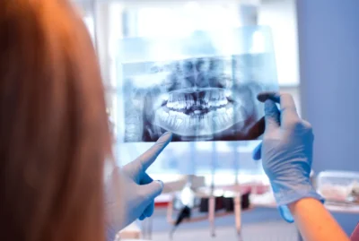 Tipuri principale de echipamente de radiologie dentara