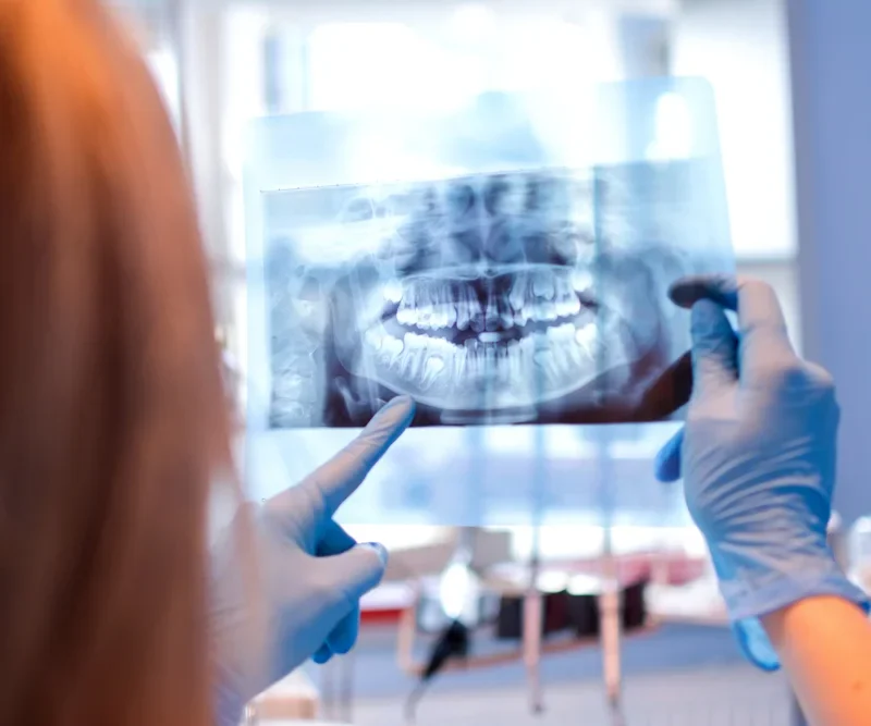 Tipuri principale de echipamente de radiologie dentara