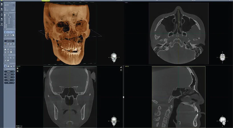 Rainbow™ CT 2 în 1