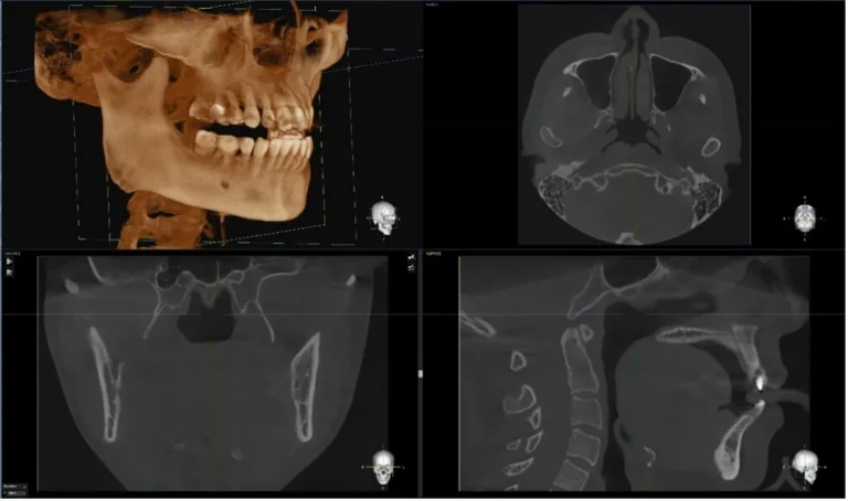 Scanare 3d Rainbow 01