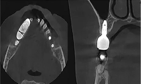 Scanare 3d Rainbow 02