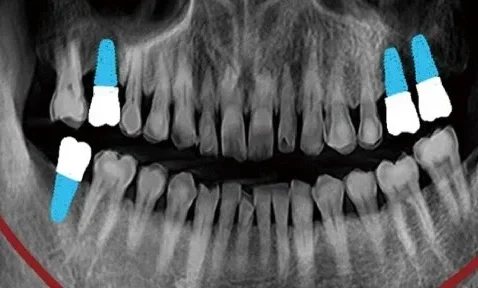 Scanare 3d Rainbow 03