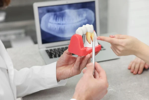 Țesuturile Moi Periimplantare