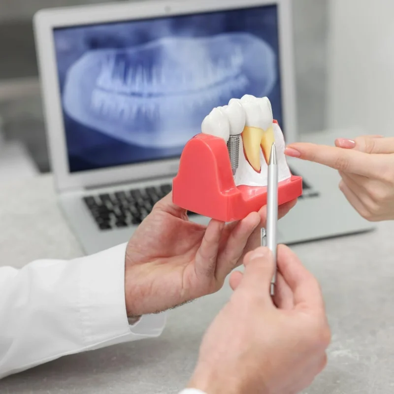 Țesuturile Moi Periimplantare