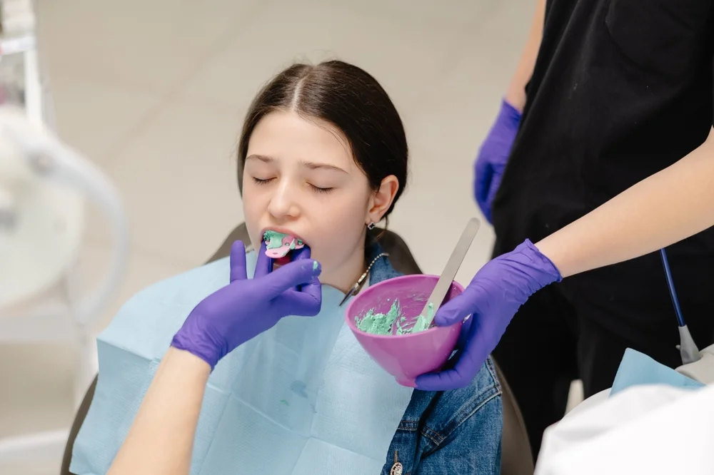 Amprentare Dentara Clasica