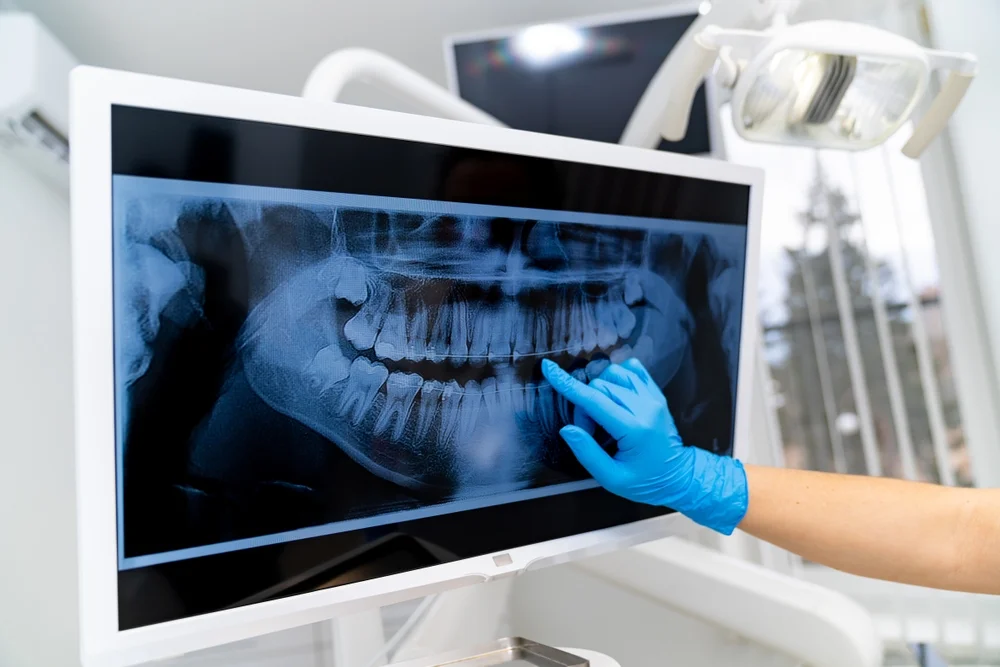 radiografie stomatologica in cabinet dentar modern