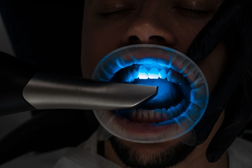 Scanare Amprenta Dentara