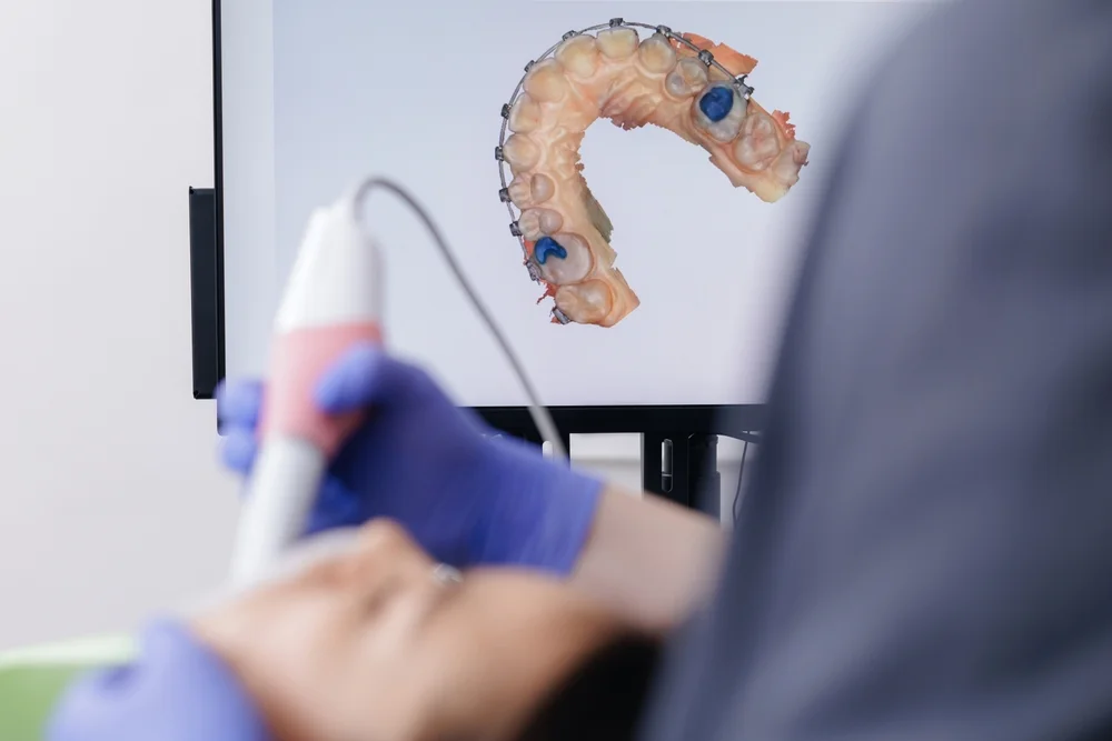 Bont de scanare: ghid practic pentru un flux digital predictibil în implantologie