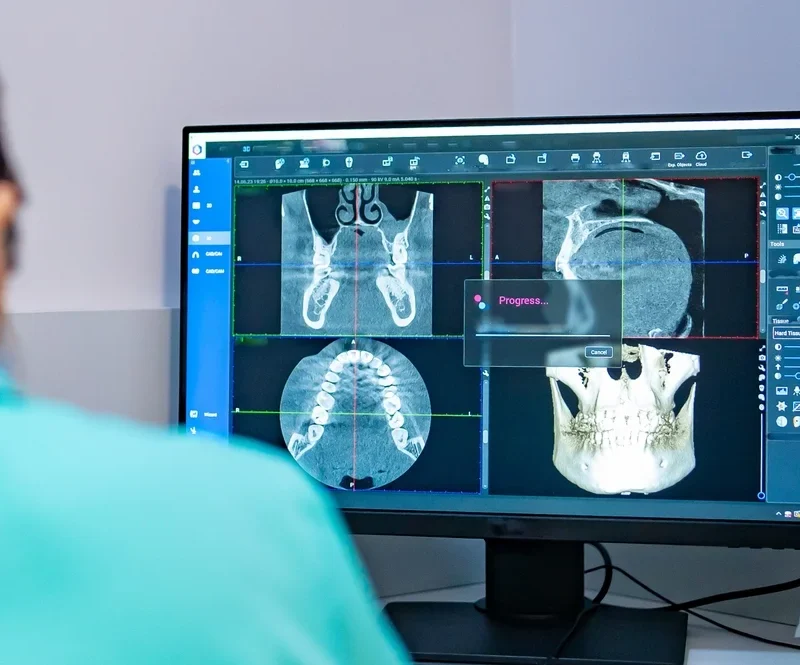 Aparat De Investigatie CBCT