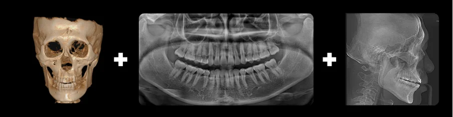 CBCT, Radiografia Panoramică și Cefalometria