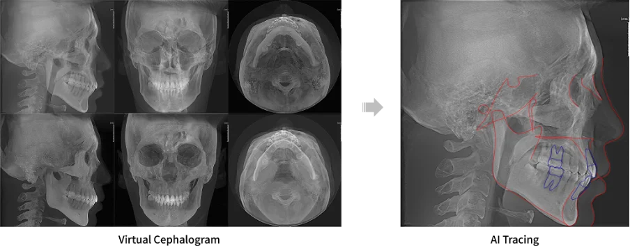 CBCT Simulare A Augmentării