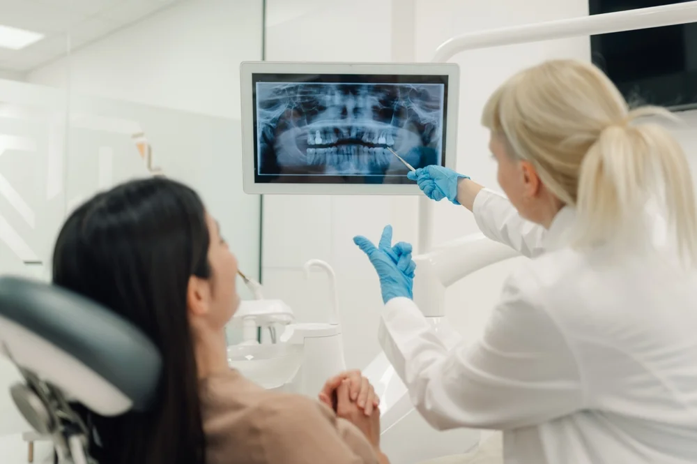 Radiografie Dentara
