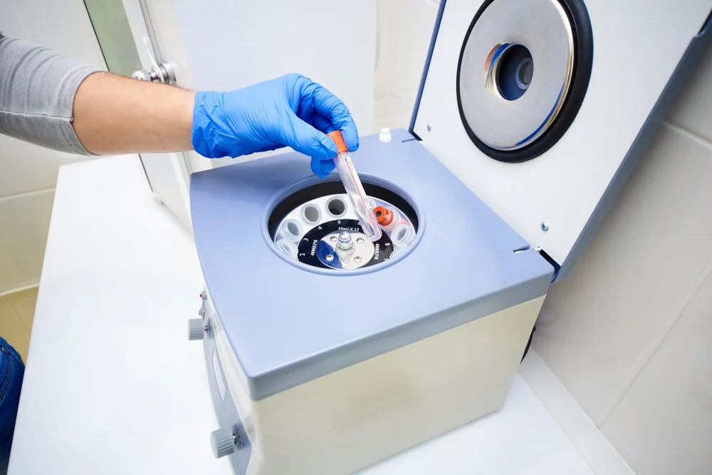 Ce criterii contează atunci când alegi o centrifugă PRF pentru clinica ta stomatologică?